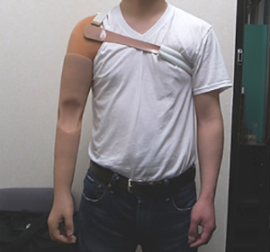 装着例:20代男性(上腕義手)