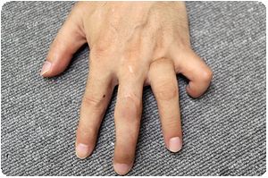 装着例:50代男性